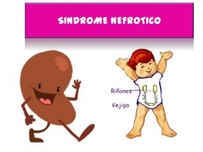Aprende a diferenciar el Síndrome Nefrótico y Nefrítico